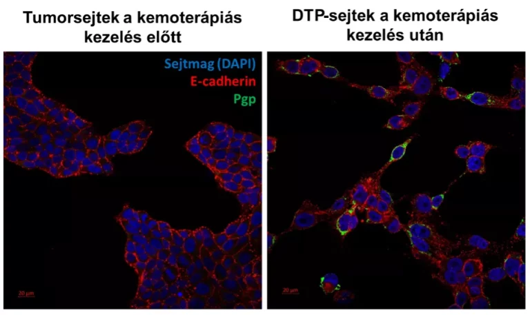 Új támadáspontot azonosítottak a HUN-REN TTK kutatói a kemoterápiát túlélő tumorsejtekben