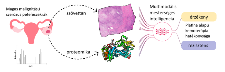 Mesterséges intelligenciával a személyre szabottabb petefészekrák-kezelésért
