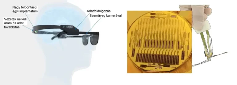 Új szakaszba lép a látásvisszaállító protézis fejlesztése