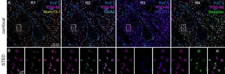 Áttörést hozhat a HUN-REN kutatóinak eljárása a skizofrénia megértésben
